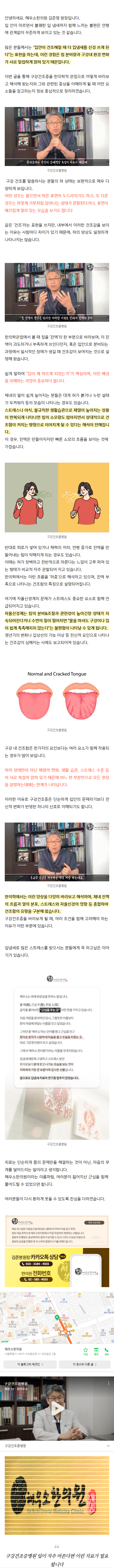 입냄새치료 mbruq