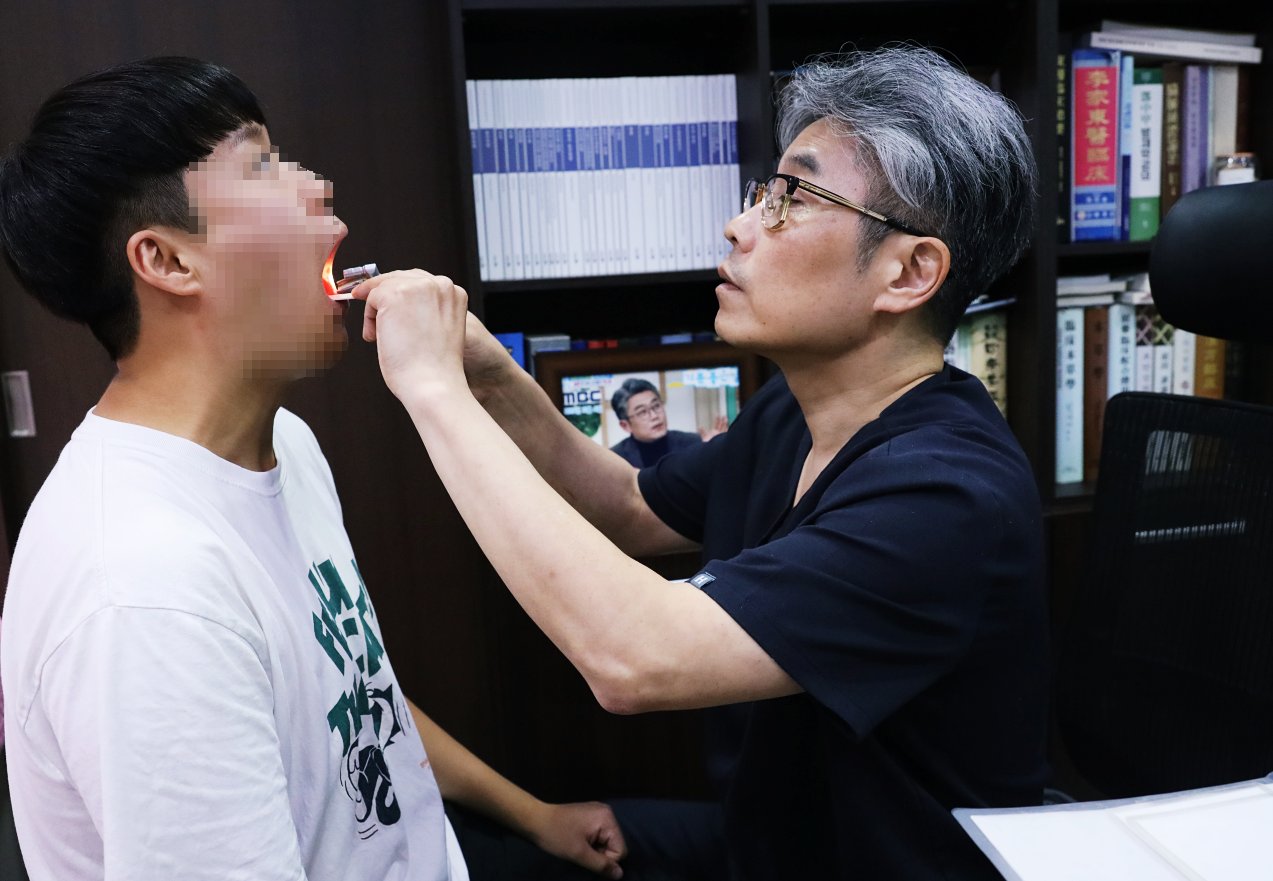 심한 입냄새 치료